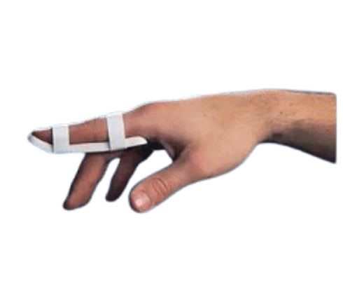 Plastalume Digital Zimmer Splint