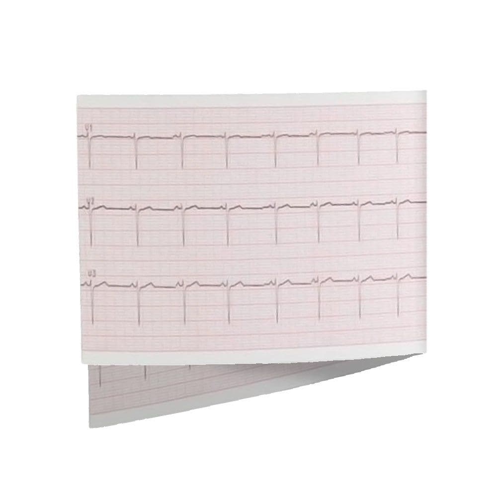 ECG Paper for all CardioPad -2 (10) ECG Paper for all CardioPad -2 (10)